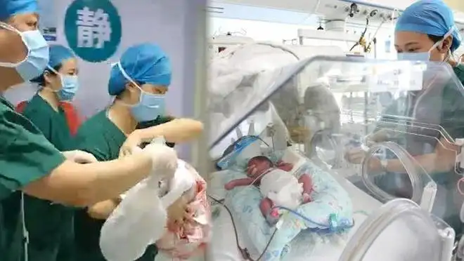 山东泰安24岁产妇早产1女4男5胞胎，这五个孩子的现状如何？